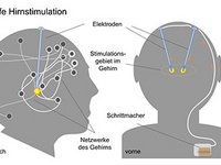 © vac/STX Uniklinik Freiburg
