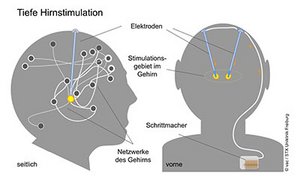 © vac/STX Uniklinik Freiburg